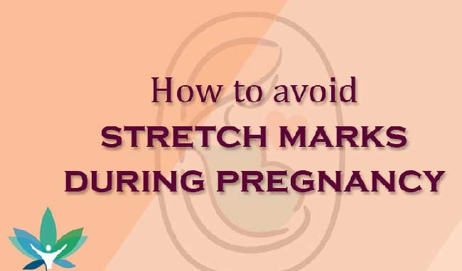 Tips to Prevent Stretch Marks During Pregnancy